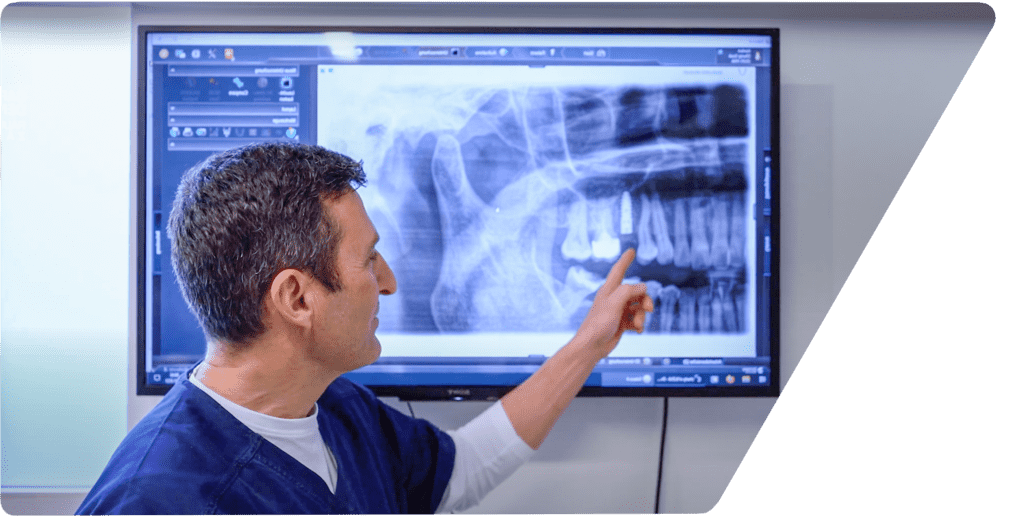 Der Zahnarzt Dr. Karapetian von Carree Dental in Köln bei der Beratung zu einer neuen Methode für Zahnersatz auf 4 Implantaten