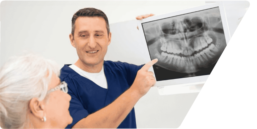 Implantat Erstberatung