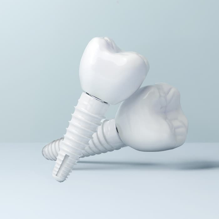 Keramikimplantate