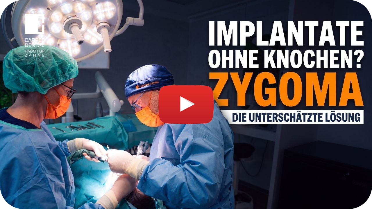 Zygoma Video